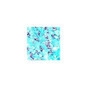 Acid Fast Bacteria (AFB) Stain Kit